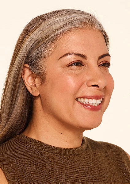 Botox after image