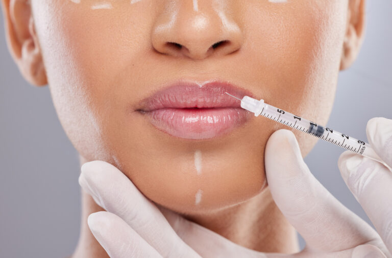 Denver Tech Dermatology | Dermal Fillers Services