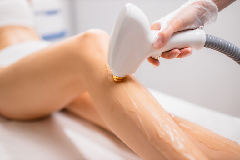 Denver Tech Dermatology | Lasers Services
