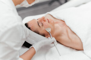 Denver Tech Dermatology | Chemical Peels